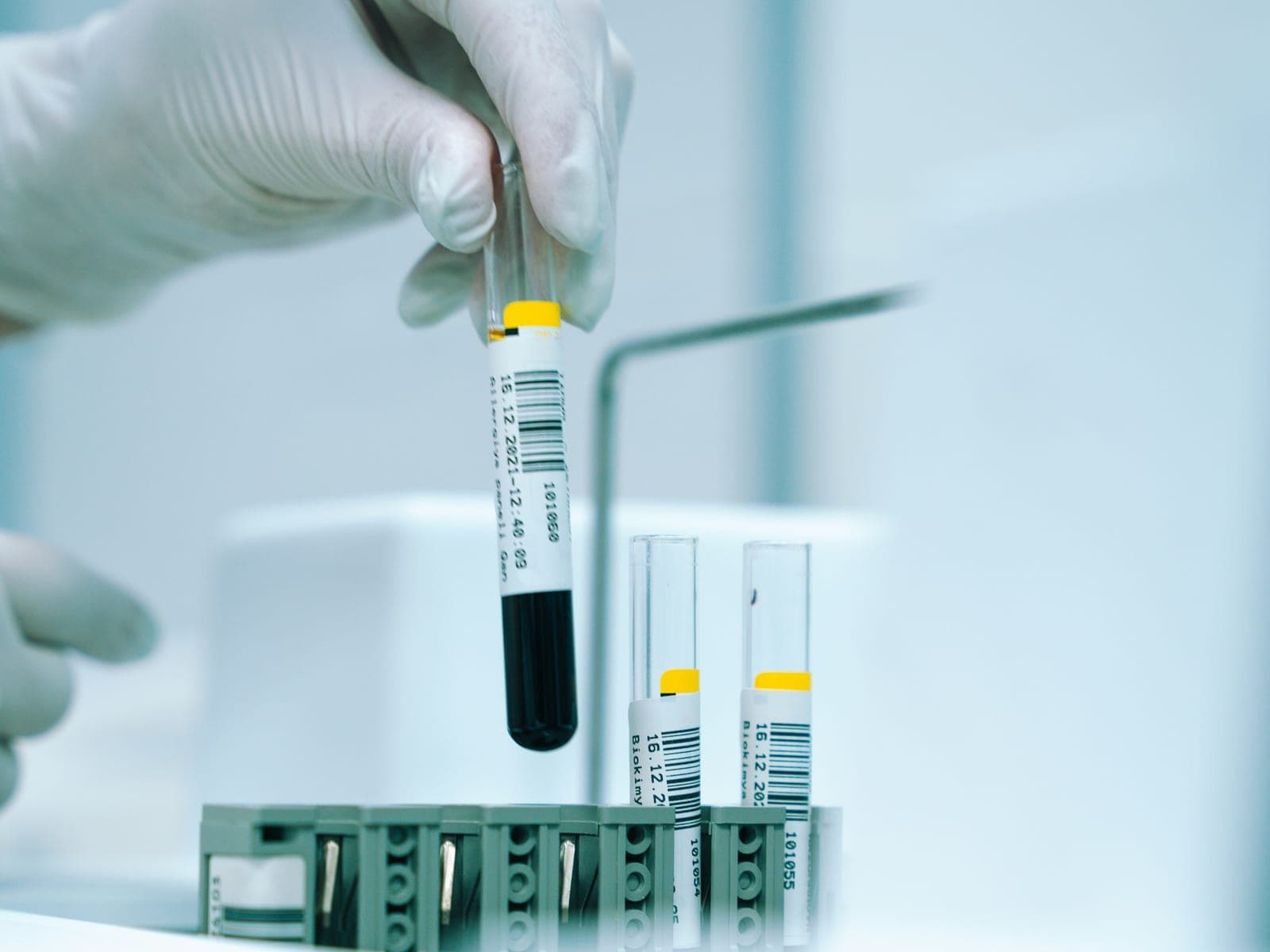 Lab sample tubes being placed in a rack